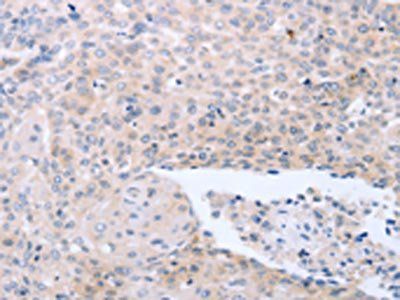 NRTN Antibody