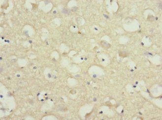 NRXN3 Antibody