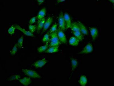 NSD2 Antibody