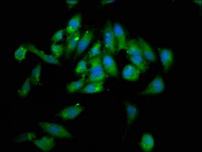 NSD2 antibody