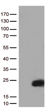 NSD3 Antibody