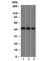 NSE Antibody / Neuron Specific Enolase