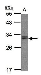 NSMCE1 antibody [N1C3]