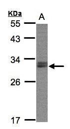 NSMCE1 antibody