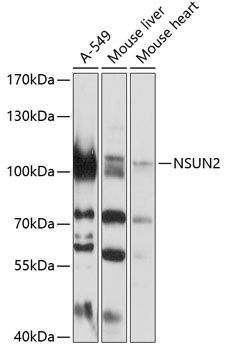 NSUN2 antibody