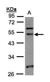 NSUN6 antibody