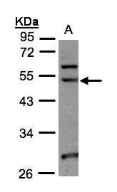 NSUN6 antibody [N3C3]