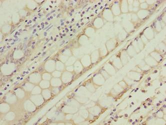 NSUN7 Antibody