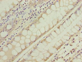 NSUN7 antibody