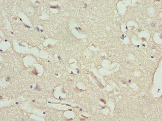 NPPB Antibody