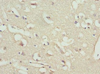 NT-proBNP antibody