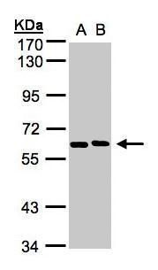 NT5C2 antibody