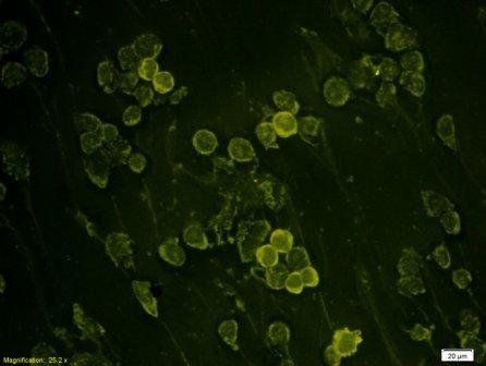 NT5C2 Rabbit Polyclonal Antibody (FITC)