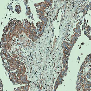 NT5C2 antibody