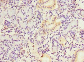 NT5C3A Antibody