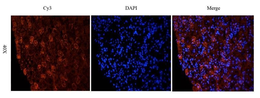 NTCP antibody