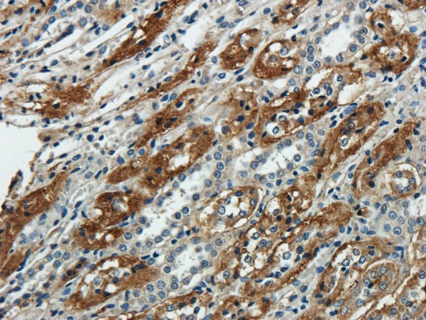 NTCP antibody