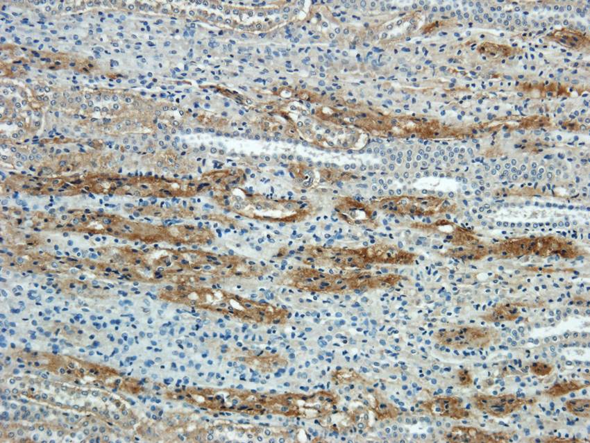 NTCP antibody