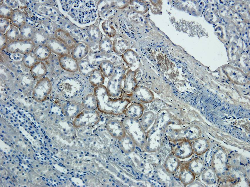 NTCP antibody