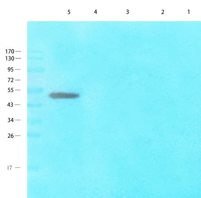 NTCP antibody