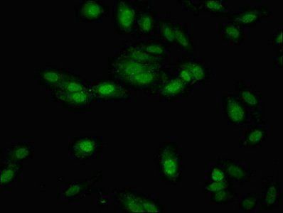 NTHL1 Antibody