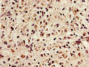 NTHL1 Antibody