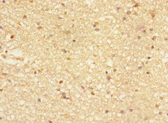 NTM Antibody