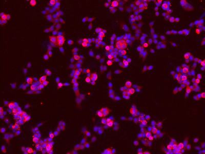 NTRK2 (Ab-705) Antibody
