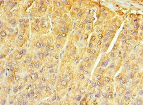 NTRK3 Antibody