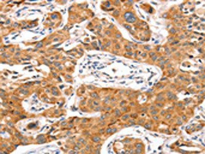 NUAK1 Antibody