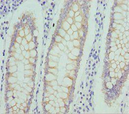 NUAK2 Antibody