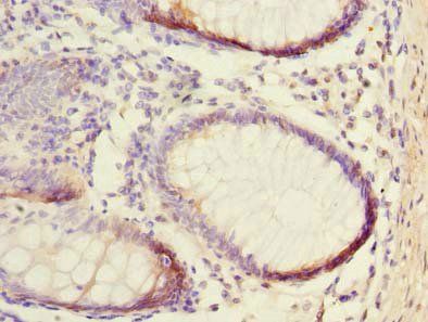 NUBPL Antibody