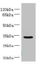 NUBPL Antibody