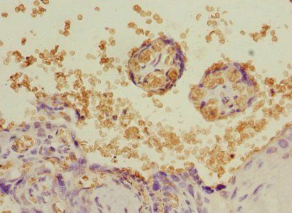 NFKB1 Antibody