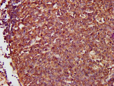 NFKB1 Antibody