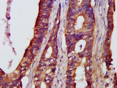 NFKB1 Antibody