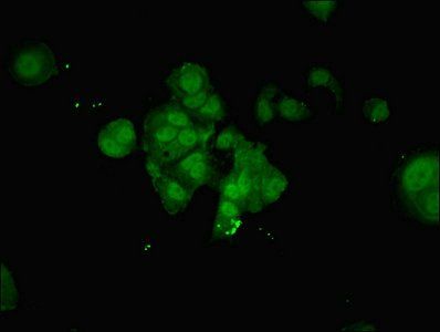 Nuclear pore glycoprotein 210 antibody