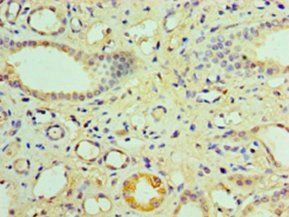 NR1I3 Antibody