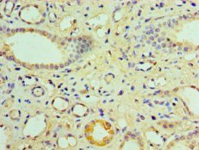 Nuclear R subfamily 1 group I member 3 antibody