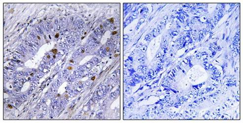 Nuclear Receptor NR4A1 (Ab-351) Antibody