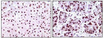 Nucleophosmin Antibody