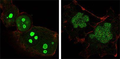 Nucleophosmin Antibody