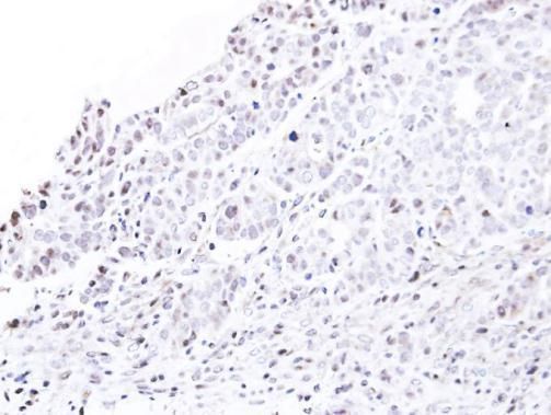 Nucleoporin p62 antibody
