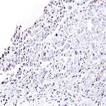 nucleoporin p62 antibody