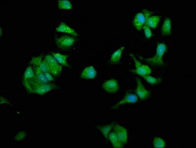 NME1 Antibody