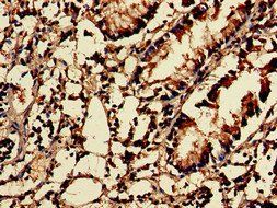 NUDT1 Antibody
