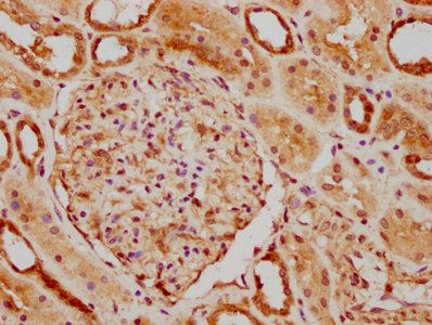 NUDT15 Antibody