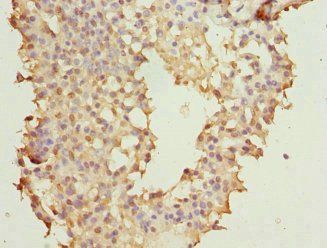 NUDT2 Antibody