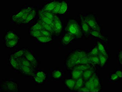 NUDT5 antibody