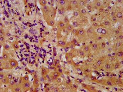 NUDT5 Antibody